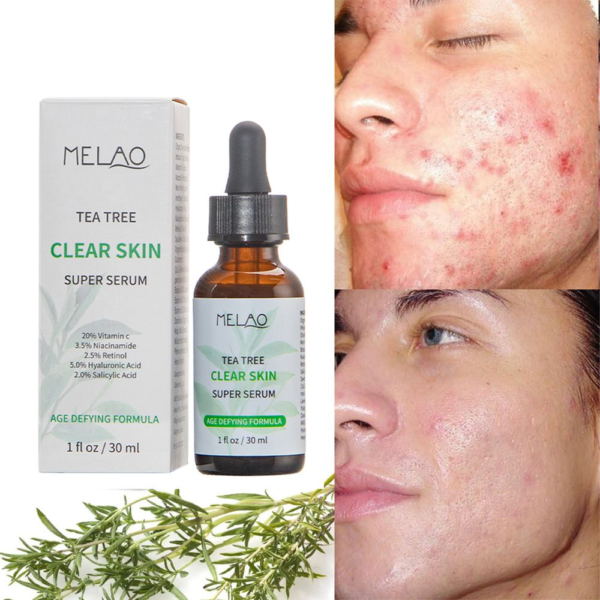 Melao Tea Tree Clear Skin Serum – 30 ml - Image 5