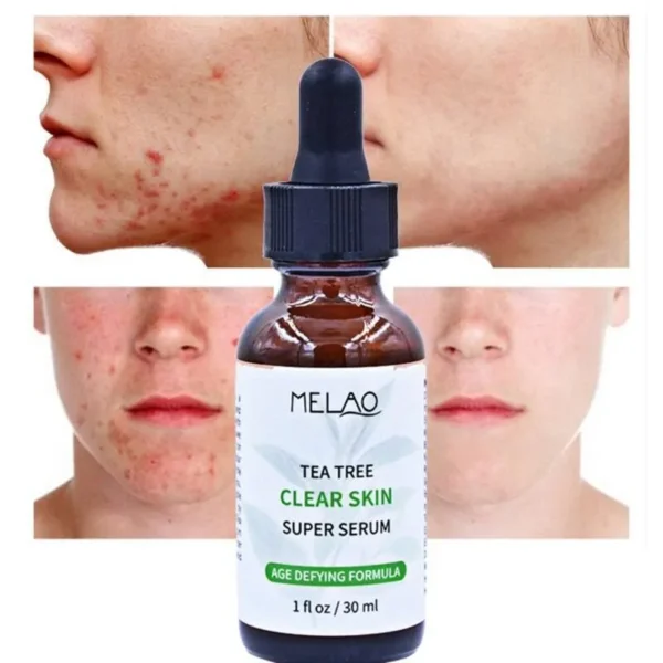 Melao Tea Tree Clear Skin Serum – 30 ml - Image 8