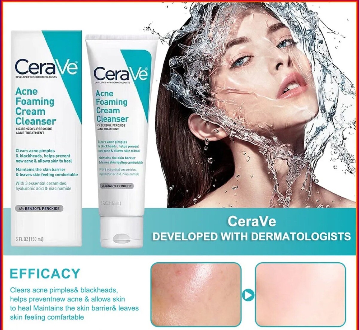 CeraVe Acne Foaming Cream Cleanser - 150ML - Image 2