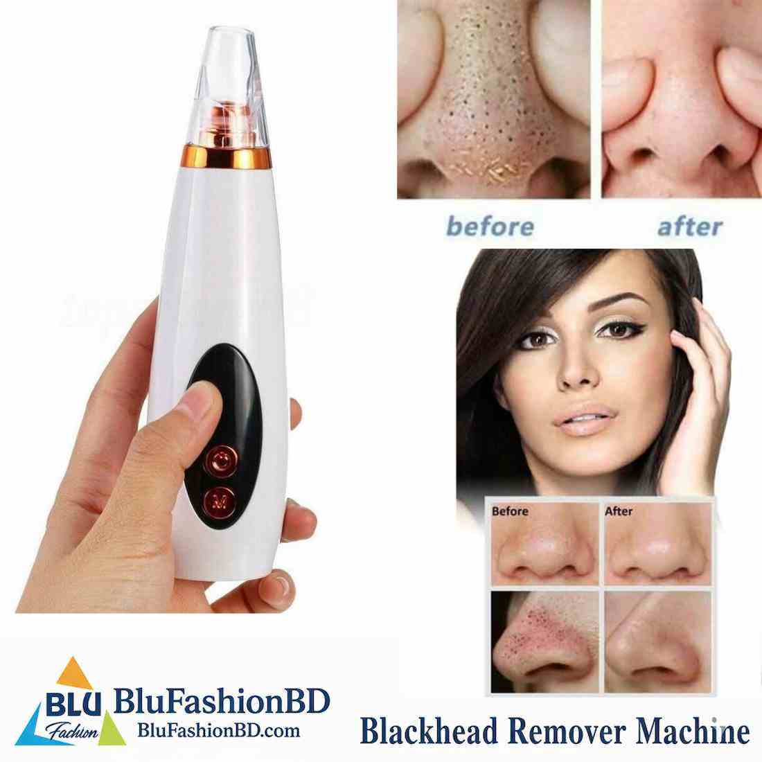 Black Head Remover Machine - Image 5